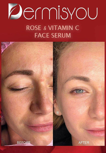 Anti-Wrinkle Facial Serum with Rose Water & Vitamin C.