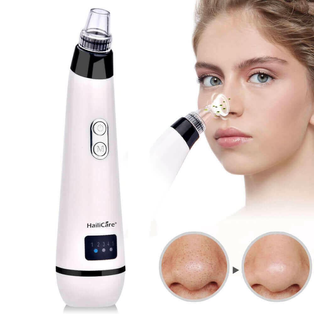 Blackhead Remover Skin Care Face Clean Pore Vacuum.