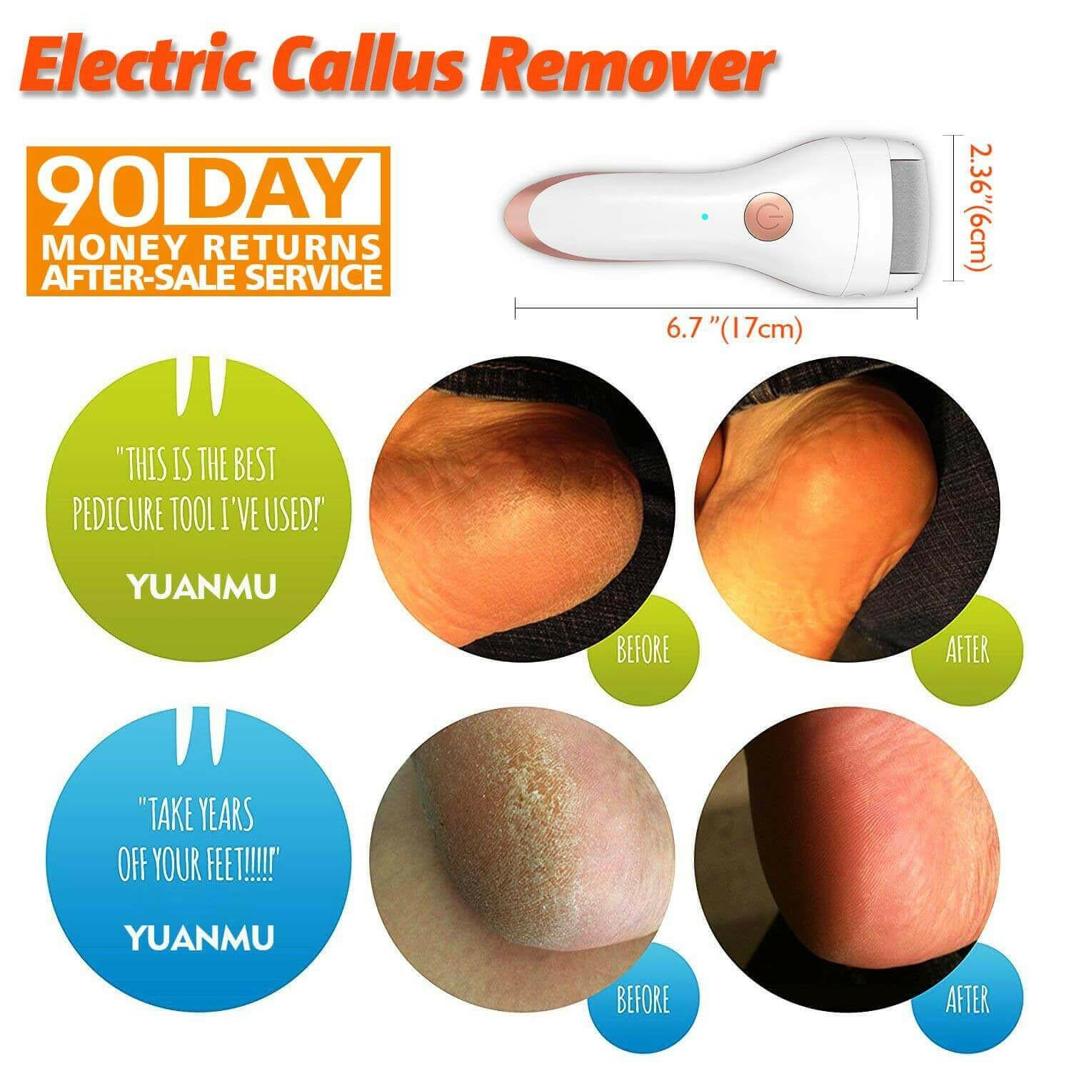 Electric Foot Callus Remover Portable Electronic Foot File.