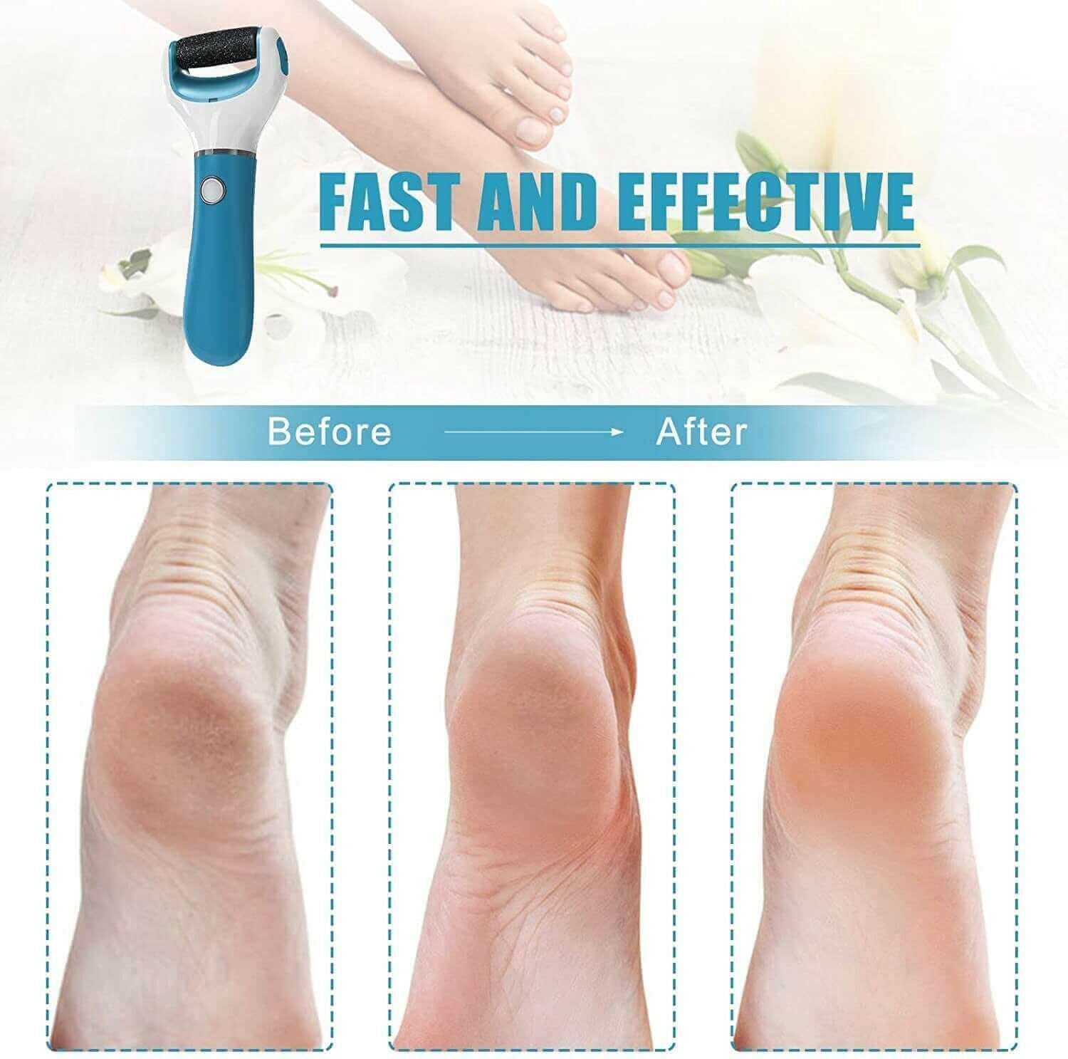 Electric USB Rechargeable Foot Grinder Heel File Grinding Exfoliator