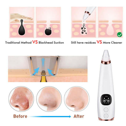 Facial microcry stalline blackhead skin beauty instrument.