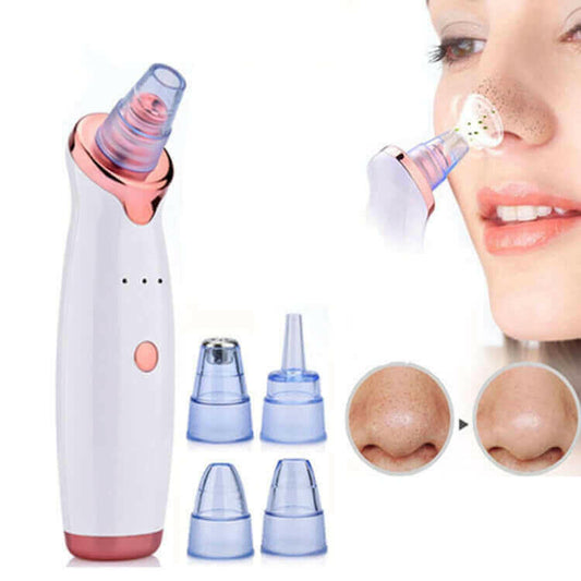 Facial Blackhead Remover Electric Vacuum Machine.